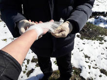 Перевязка большого пальца руки, с внешней стороны пальца